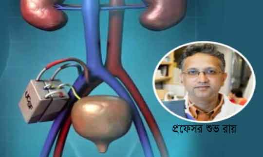 Artificial Kidney, Dr.Subhra Roy, Kidney
